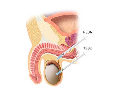 南京代孕网的代孕流程