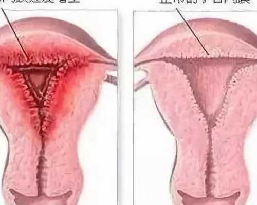 四川代孕简介,哪里有女人代孕的