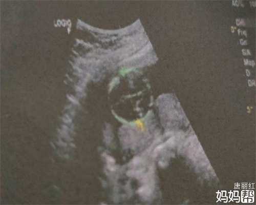 代孕合同有效性_在代孕可靠吗_[广州试管成功率排行]北京妇产医院做试管婴儿