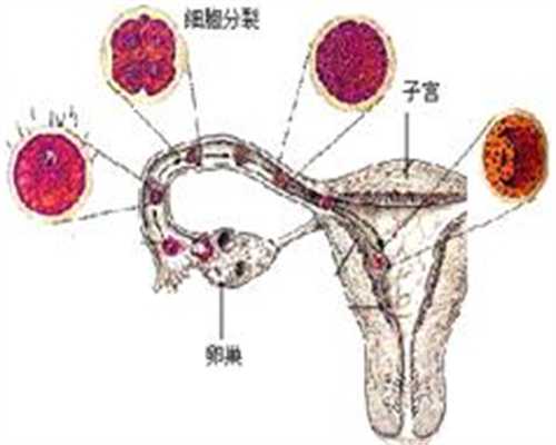 代孕那里较好_代孕辅助生殖_四川省人民医院做试管婴儿的成功率高不高？