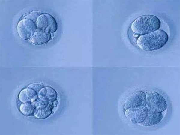 西城哪里有借腹生子_西城代孕DNA检测_试管婴儿优胚和普胚的区别，一览本文即