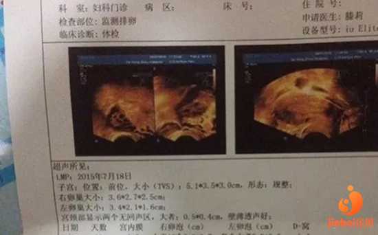 铜陵代孕的成功率多少_铜陵代孕一个孩子花费_深圳中山医院做试管婴儿技术好