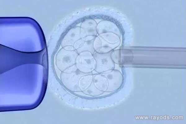 佛山做代孕全过程介绍_佛山在哪找代孕_美国试管婴儿，哪些人需要养囊？