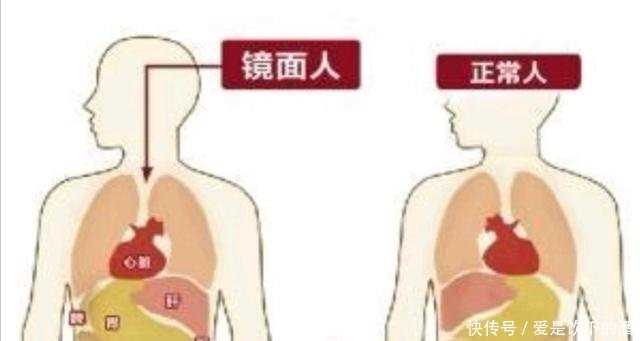 南京代孕需要血型一样吗_南京哪些人适合做代孕_试管婴儿双胞胎可取吗，对母