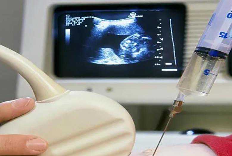 代孕有人做吗|定了！安徽这家大型妇幼保健院即将试运行,沈阳代孕2023